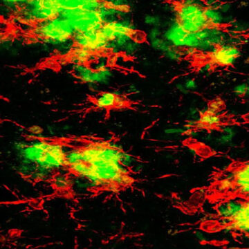 Microglia cells. (Photo credit: Green lab / UCI)