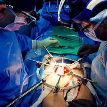 Record-breaking 61-day pig kidney experiment offers hope for organ transplant patients